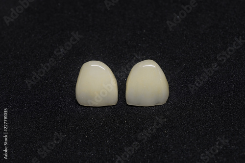 ceramic crown isolate on black background