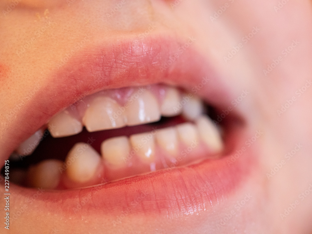 Obraz premium Red lips, even white teeth and pink tongue. Baby finger in mouth. A boy of 3 years. Macro close up