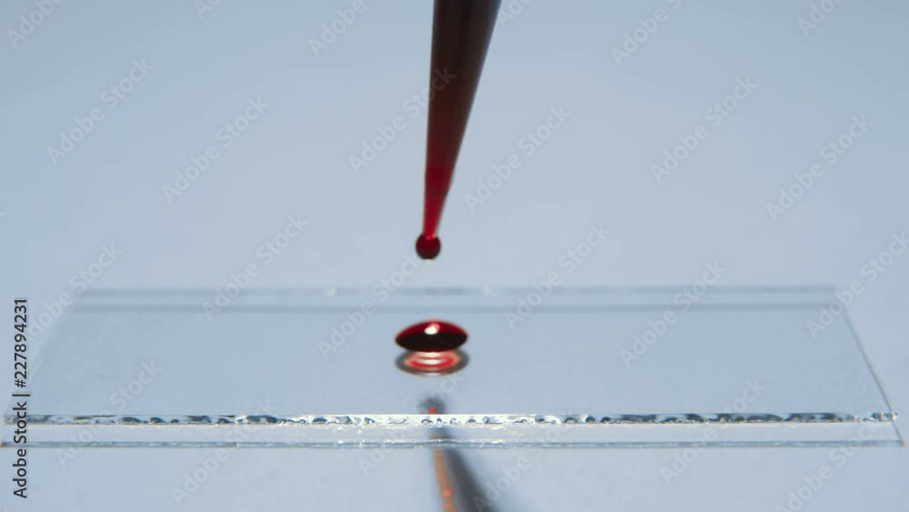 Drop of blood between two microscope slides, microscope glass, sample ...