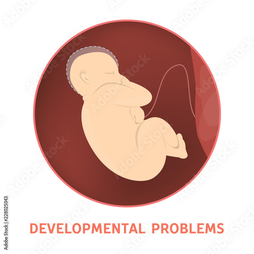 Medical reasons for cesarean delivery or c-section