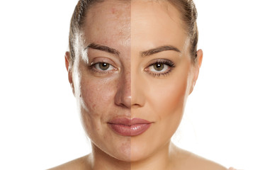 Makeover concept. Woman without and with makeup on white background