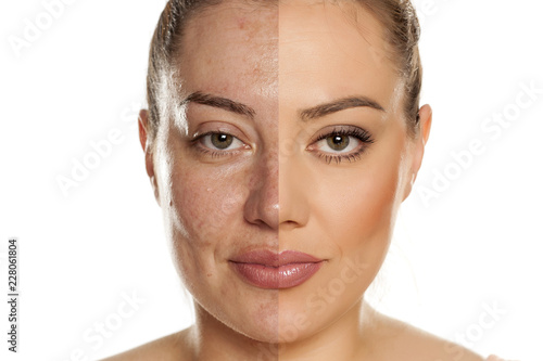 Makeover concept. Woman without and with makeup on white background