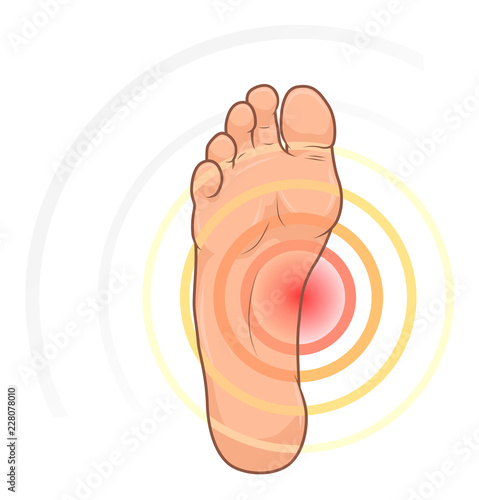 Foot with pain