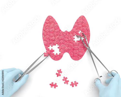 Thyroid puzzle concept: hands of surgeon with surgical instruments (tools) performs thyroid surgery as a result of hypothyroidism, thyroid adenoma, thyroadenitis, euthyroid goiter, iodine deficiency photo