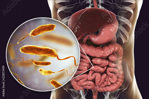 Vibrio cholerae bacteria in small intestine, 3D illustration. Bacterium which causes cholera disease and is transmitted by contaminated water photo
