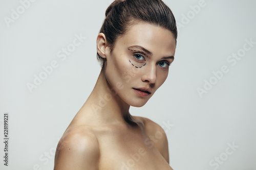 Woman face with dotted lines before plastic surgery