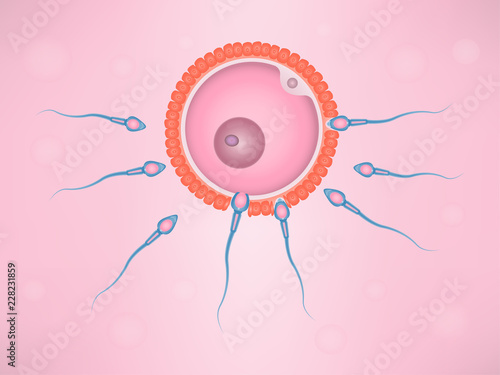 Human fertilization in uterus of an ovum and a spermatozoon. 