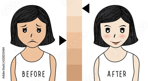 vector woman face. acne before and after. skin care illustration.