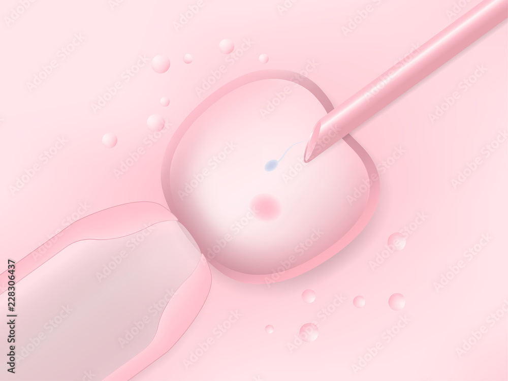 In vitro fertilization, the egg is the holding pipette and needle close up. Vector ESP10 In vitro fertilization, the egg is the holding pipette and needle close up. Vector ESP10