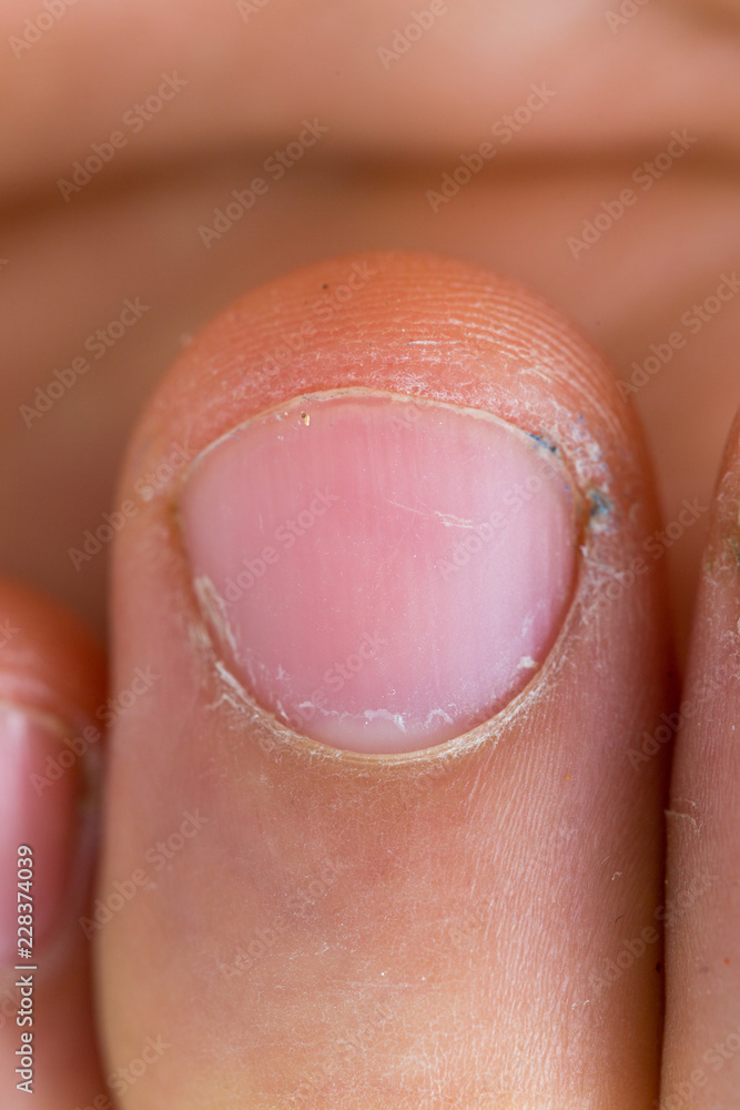 Fototapeta premium human finger, macro