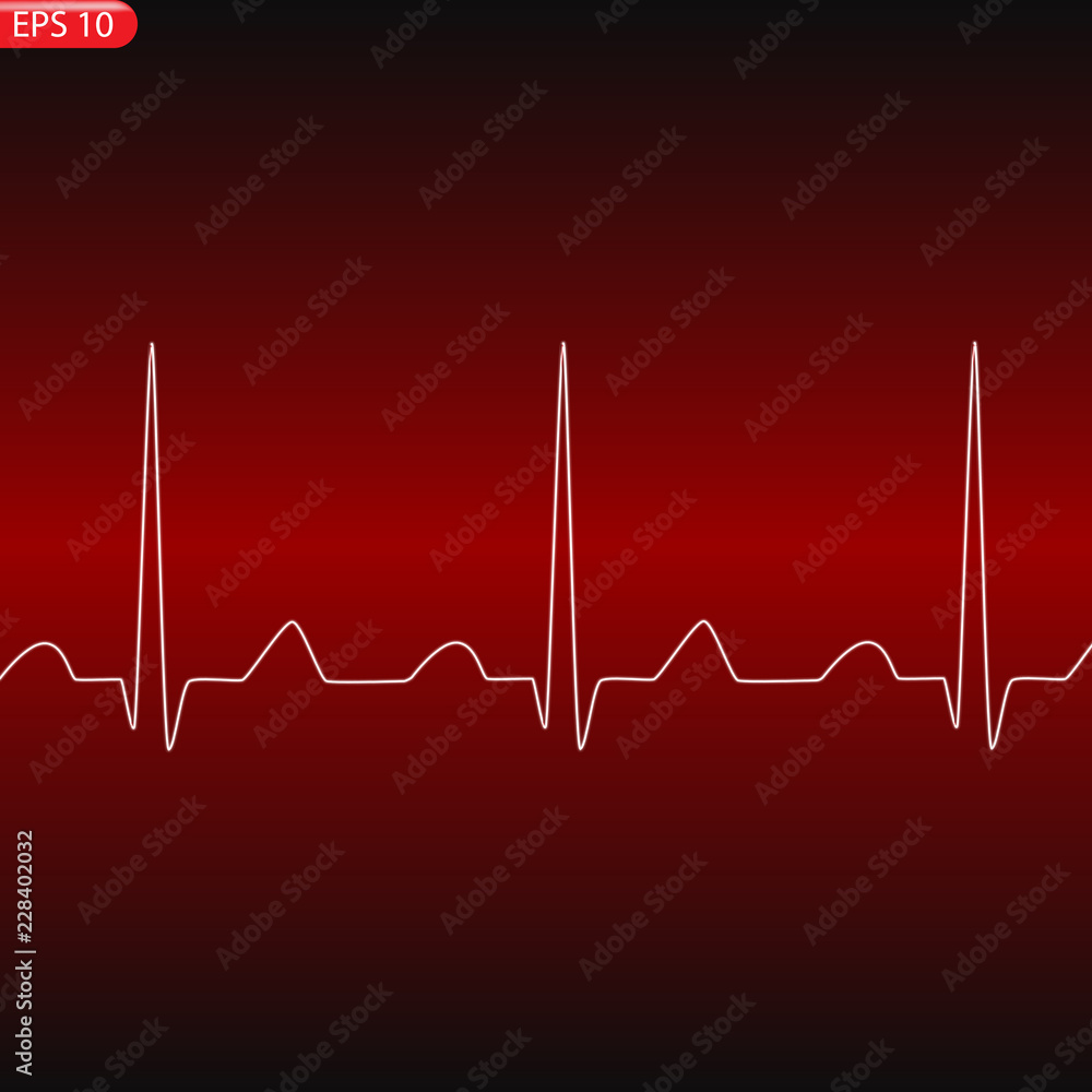 Cardiology concept with pulse rate diagram