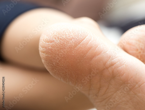 Feet of women in bed close-up