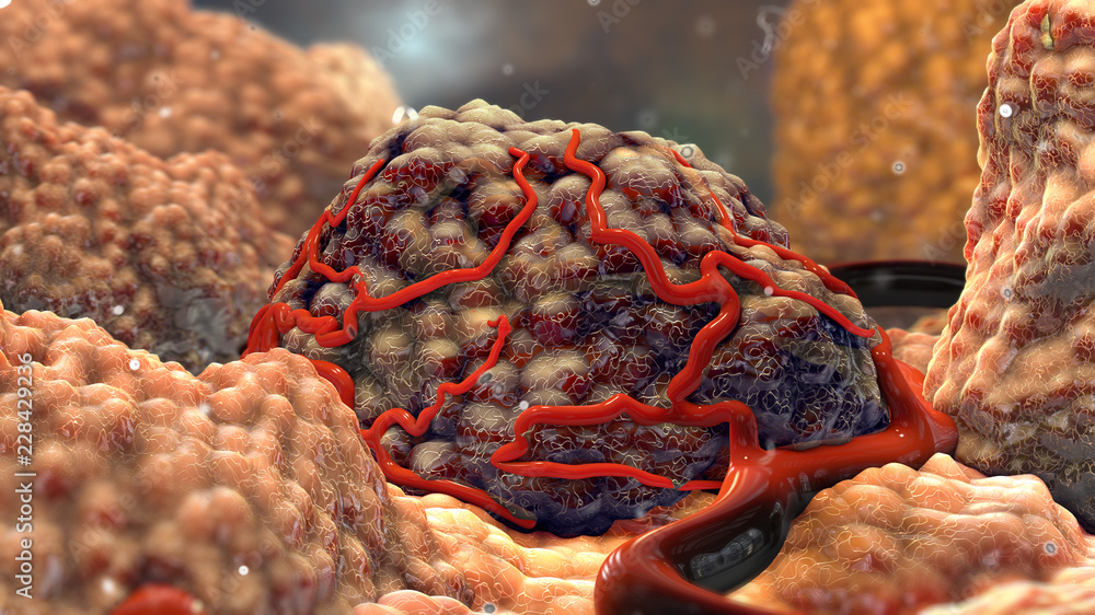 3D Tumor Cancer Cells - obrazy, fototapety, plakaty 