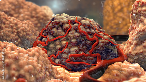 3D Tumor Cancer Cells photo