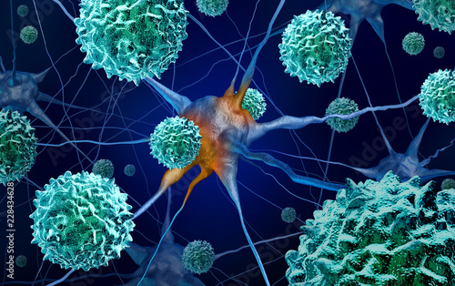 Quadro em tela AFM Disease