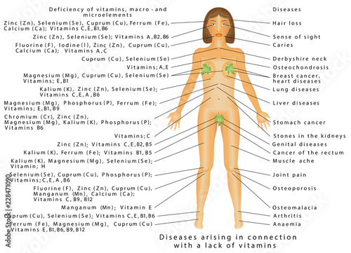 Vitamin deficiency