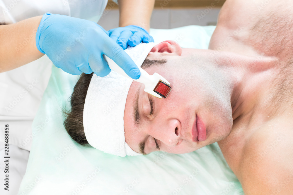 The man undergoes the procedure of medical micro needle therapy with a modern medical instrument derma roller. The man undergoes the procedure of medical micro needle therapy with a modern medical instrument derma roller.