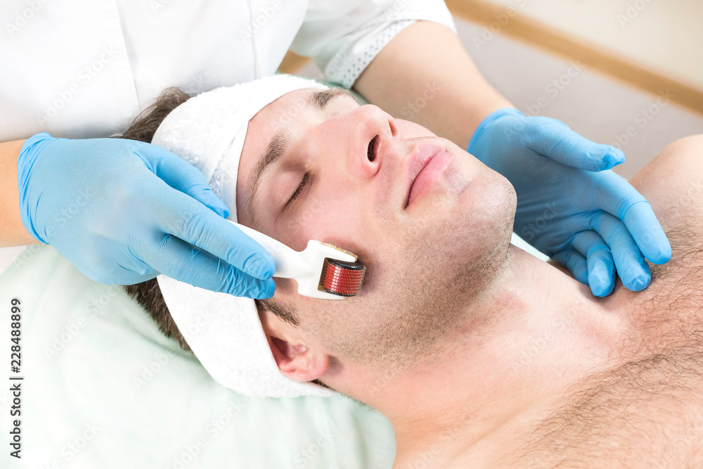 The man undergoes the procedure of medical micro needle therapy with a modern medical instrument derma roller. The man undergoes the procedure of medical micro needle therapy with a modern medical instrument derma roller.