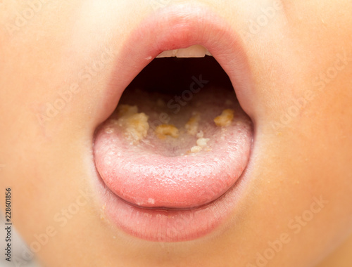 Macro image of a boy sticking her tongue out