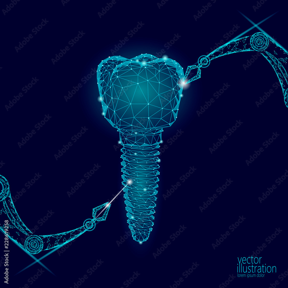 3d tooth innovation robot arm polygonal concept. Stomatology symbol low  poly triangle abstract oral dental medical care business. Connected dot  particle implant render blue vector illustration Stock Vector | Adobe Stock
