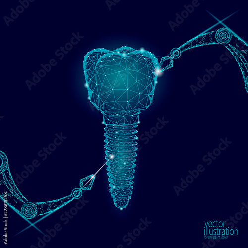 3d tooth innovation robot arm polygonal concept. Stomatology symbol low poly triangle abstract oral dental medical care business. Connected dot particle implant render blue vector illustration