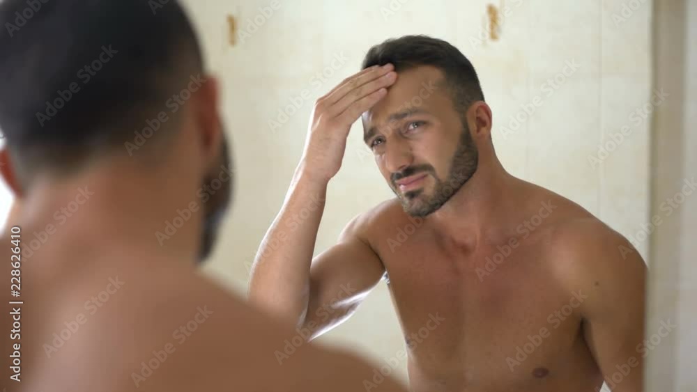 Man worried about dark circles under eyes and unhealthy complexion after party Man worried about dark circles under eyes and unhealthy complexion after party