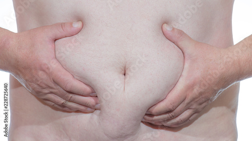 an elderly, overweight man reaches into his belly fat 