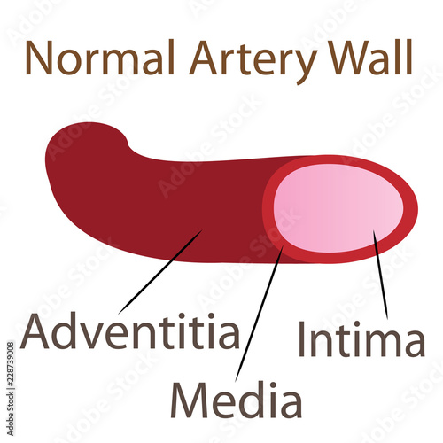 Normal artery wall illustration