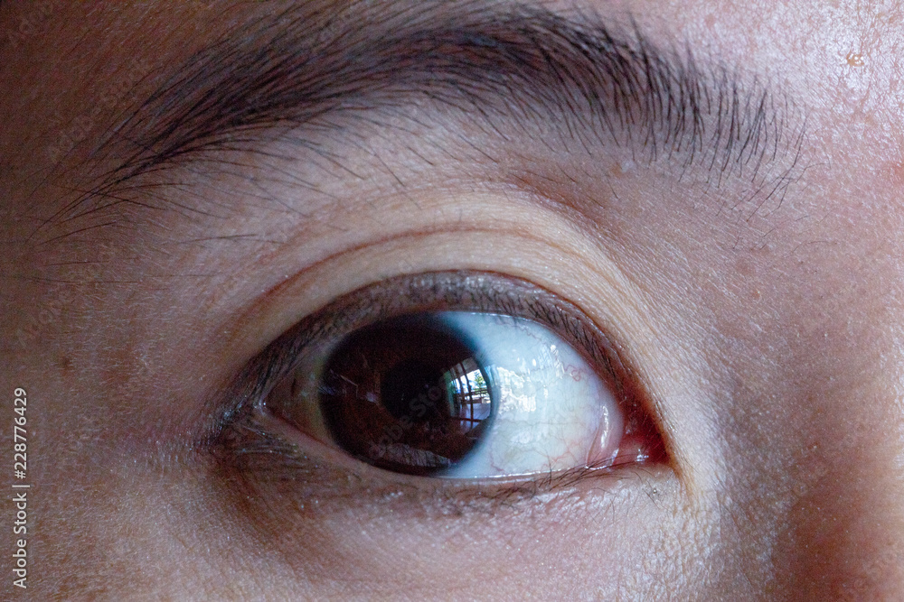 Fototapeta premium the eye closeup