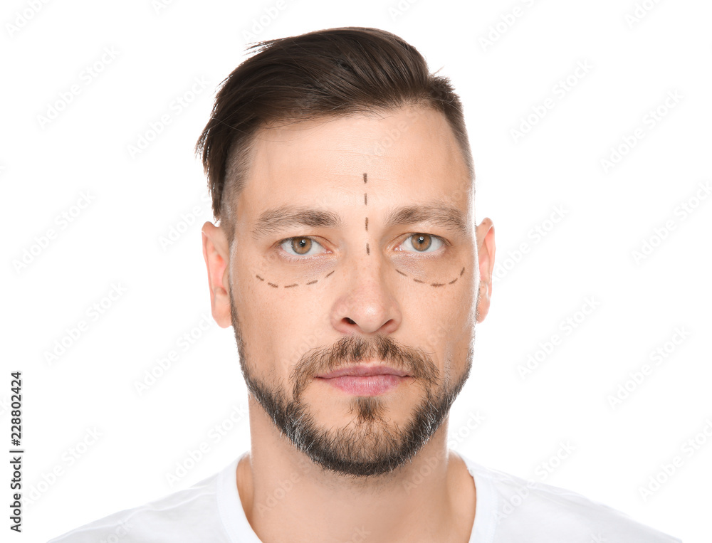 Obraz premium Portrait of mature man with marks on face preparing for cosmetic surgery against white background