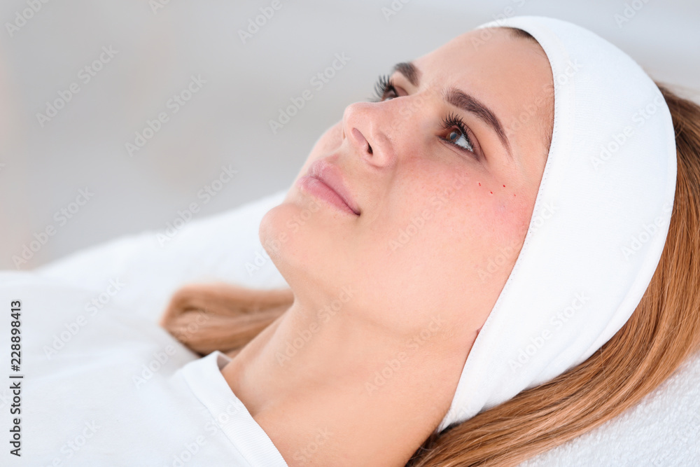 Woman after face biorevitalization procedure in salon, closeup. Cosmetic treatment Woman after face biorevitalization procedure in salon, closeup. Cosmetic treatment