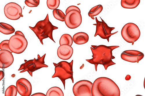 Acanthocytes, abnormal red blood cells with thorn-like projections, 3D illustration. They appear in severe liver disease, vitamin E defficiency, splenectomy, malabsorption, hypothyroidism photo