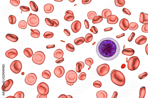 Iron deficiency anemia, 3D illustration showing small hypochromic red blood cells, anisocytosis. A small lymphocyte is drawn for size comparison photo