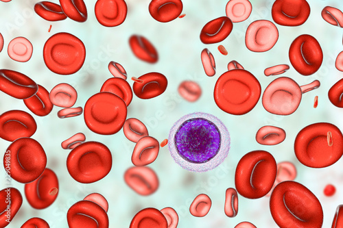 Hemotransfusion in treatment of anemia, 3D illustration showing two populations of red blood cells, small hypochromic red blood cells and normal. A small lymphocyte is drawn for size comparison photo