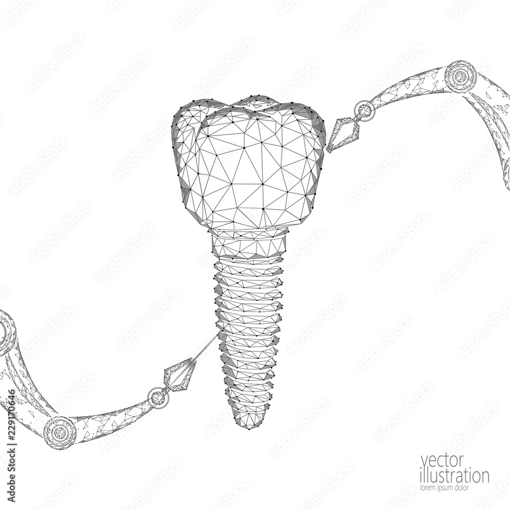 3d tooth innovation robot arm polygonal concept. Stomatology symbol low  poly triangle abstract oral dental medical care business. Connected dot  particle implant render blue vector illustration art Stock Vector | Adobe  Stock
