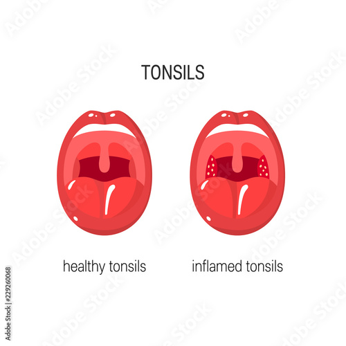 Tonsils vector illustration