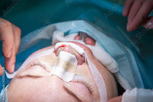 Surgeon and his assistant performing cosmetic surgery on nose in hospital operating room. Nose reshaping, augmentation. Rhinoplasty.