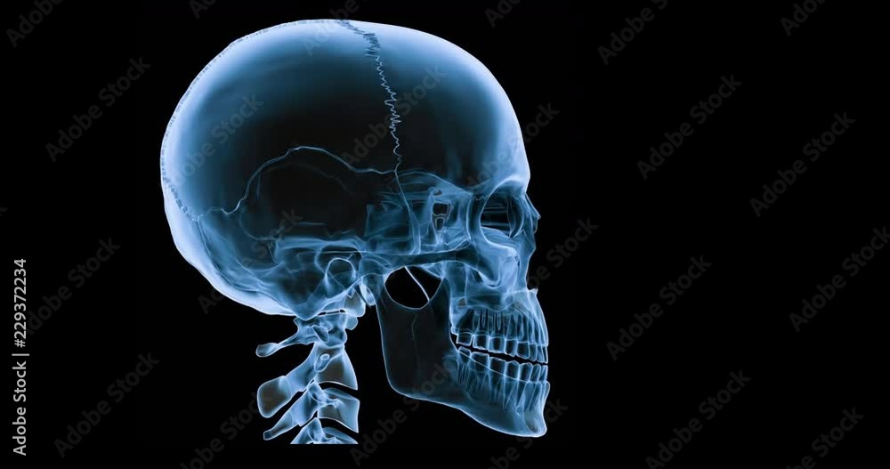 An animated x-ray of a human skull talking. An animated x-ray of a human skull talking.