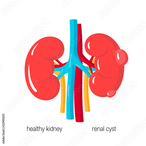 Polycystic kidney disease vector