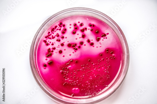 Colonies of Streptococcus bacteria