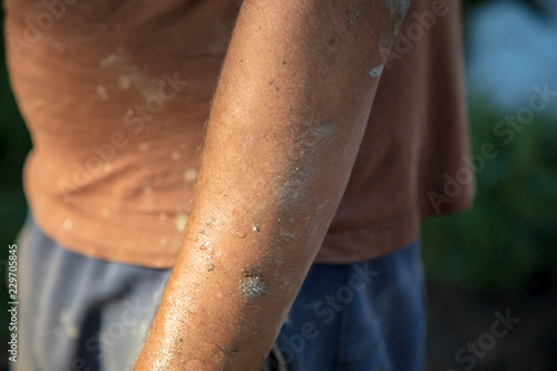 Dirty hands of a worker at a construction site