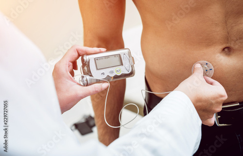 Doctor with an insulin pump connected in patient abdomen and holding the insulin pump at his hands.