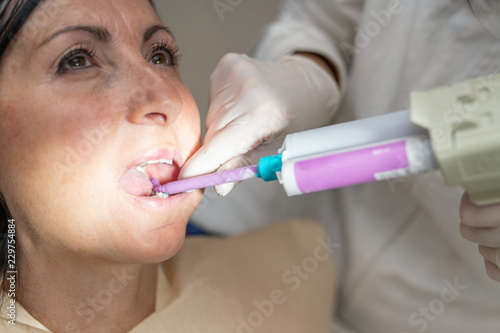 Dentist using silicone dental imprint on a woman s mouth in a dentist room