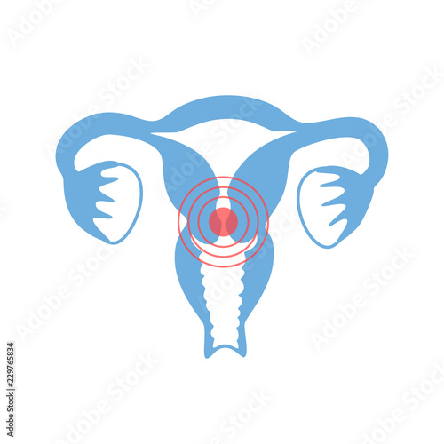 Vector isolated illustration of uterus with pain