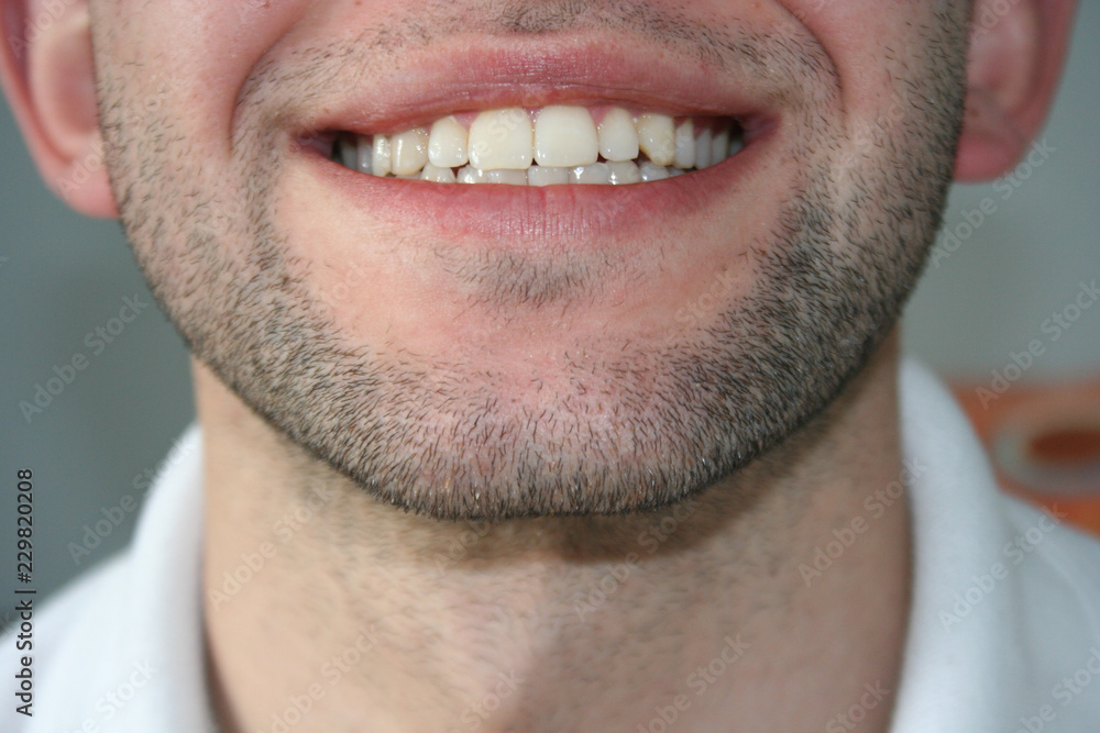 A smile of a young man with a slight beard. The guy smiles and shows his teeth.