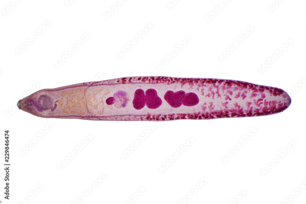 Liver fluke(Parasitic flatworm) of cattle and other grazing animals Liver fluke(Parasitic flatworm) of cattle and other grazing animals