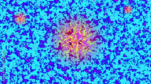 Malignant growth in microscopic tissue sample simulation. photo