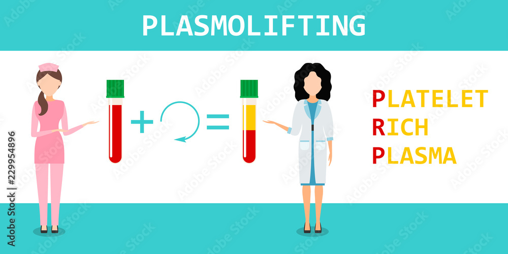 Platelet rich plasma. PRP method. Vector. Platelet rich plasma. PRP method. Vector.