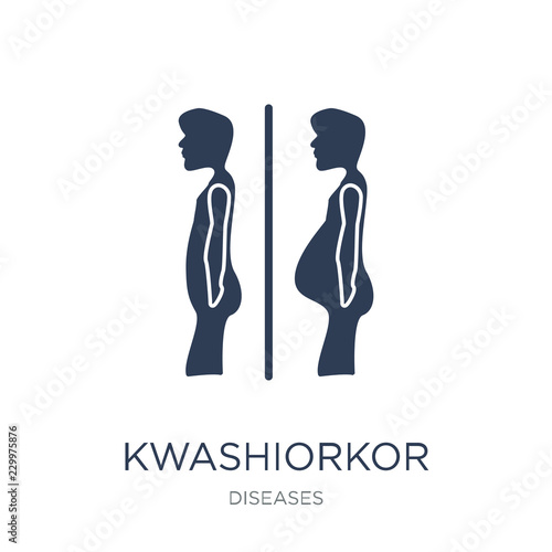 Kwashiorkor icon. Trendy flat vector Kwashiorkor icon on white background from Diseases collection