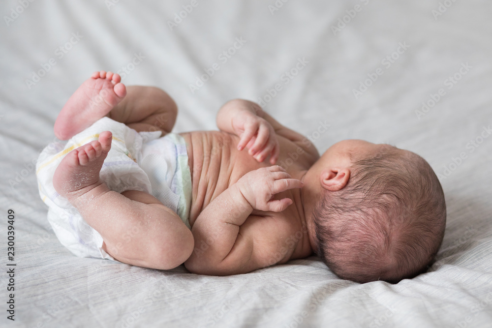 The Legs Of The Newborn Baby The Legs Of The Newborn Flaky Skin Peel Off The Skin Peeling Skin Newborn Newborn Child Feet Stock Photo Adobe Stock
